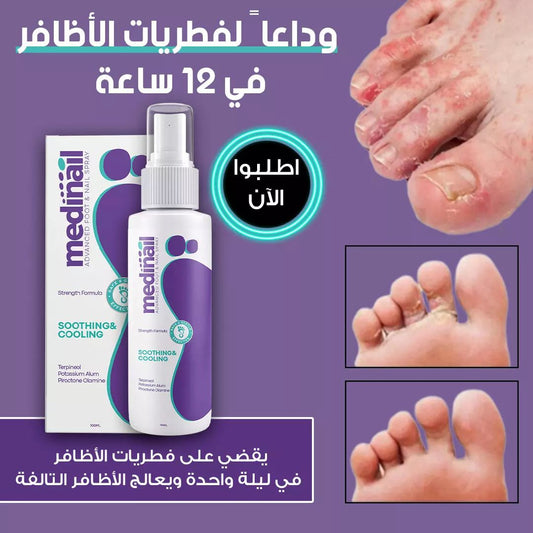 MEDNAIL™ اسبراي فطريات الأظافر