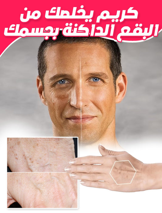 pinksense® لعلاج البقع الداكنة